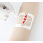 Skin Closure Device Manufacturer - Disposable Zip Sutures