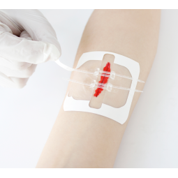 Skin Closure Device Manufacturer - Disposable Zip Sutures