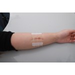 Wound Closures Supplier - Disposable Repair Device