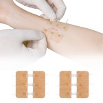 Wound Closure Strips Supplier - Butterfly Bands Laceration
