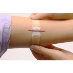 Butterfly Kit Supplier - Zip Stitch Wound Closure