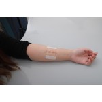 Wound Closures Supplier - Disposable Repair Device