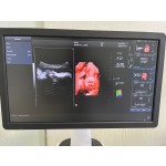 Color Doppler Ultrasound Manufacturer - 4D 5D HD LIVE OB GYN