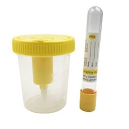 Urine Cups Supplier - Medical Vacuum 30ml 120ml