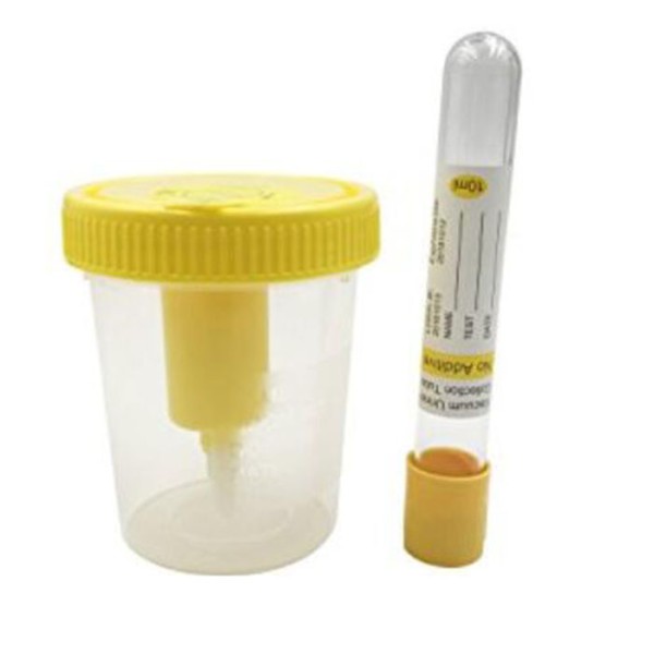Urine Cups Supplier - Medical Vacuum 30ml 120ml