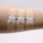 Butterfly Kit Supplier - Zip Stitch Wound Closure