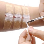 Wound Closure Device Factory - Emergency Zip Sutures