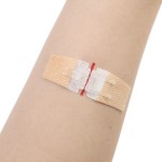 Wound Closure Strips Supplier - Butterfly Bands Laceration