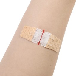 Wound Closure Strips Supplier - Butterfly Bands Laceration