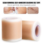 Silicone Scar Sheets Factory - Professional Keloid Treatment