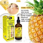 Best Selling 7-Day Pineapple Repair Serum Dark Spots Old Scar Knuckle & White Patches Corrector Serum