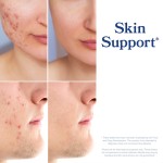 Estrogen Balance Factory - Menopause Hot Flashes Support