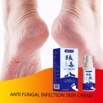 Psoriasis Spray Factory - Foot Odor Herbal