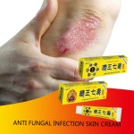 Anti-Itch Cream Supplier - Pruritus Eczema