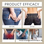 Anal Cream Manufacturer - Anti-Itch Cross-Border