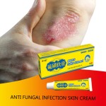 Psoriasis Ointment Supplier - Anti-Inflammatory Itching