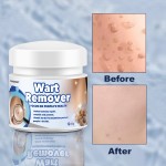 Anal Fissure Cream Manufacturer - Hemorrhoid Relief