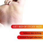 Eczema Cream Manufacturer - Anti-Itch Plant Body