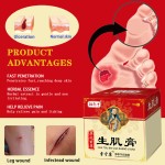 Foot Cream Manufacturer - Onychomycosis Formula