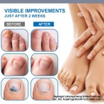 Knee Ointment Manufacturer - Synovial Meniscus Pain