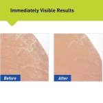 Foot Peel Spray Supplier - Exfoliates Dead Skin