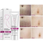 Stretch Mark Cream Supplier - Pregnancy Scar Removal