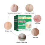 Keloid Scar Patch Factory - Stretch Marks