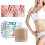 Silicone Patch Supplier - Gel Remover OEM
