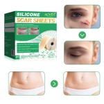 Keloid Scar Patch Factory - Stretch Marks