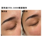 448k Tecar Device Manufacturer - Pain Relief