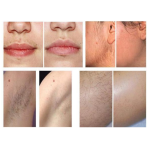 Hair Removal Cream Factory - Depilatory