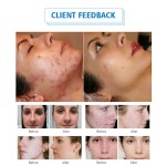 Shockwave Therapy Supplier - Pain Relief