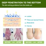 Foot Care Cream Factory - Herbal Crack Repair Moisture