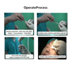 PRP Activator Supplier - Hot Sale OEM Custom