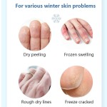 Herbal Foot Cream Manufacturer - Anti Drying Crack Repair