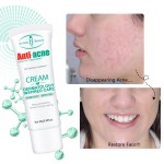 Face Moisturizer Supplier - HG Brighten Reduce Acne