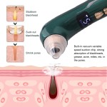 Pore Cleaner Manufacturer - Blackhead Remover Vacuum Camera