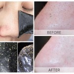 Blackhead Remove Mask Supplier - Peel Nasal Strips Deep