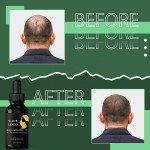 Taramira Oil Supplier - Hair Growth Stimulant