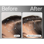 Hair Loss Serum Manufacturer - Vegan Regrowth