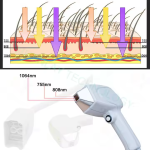 Diode Laser Machine Manufacturer - 808 Titanium Laser
