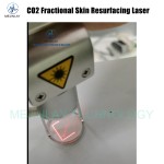 CO2 Laser Manufacturer - Fractional Skin Resurfacing