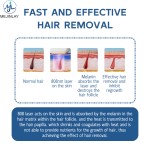 Ice Laser Machine Factory - 808 810nm Diode Professional