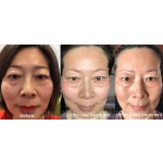 LED Photon Mask Factory - Foldable 7 Colors PDT