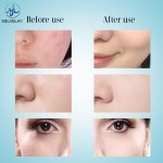 Optical Therapy Equipment Manufacturer - 7 Colors Collagen