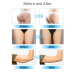 EMS Slimming Belt Supplier - Belly Fat Removal Custom