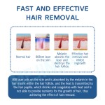 Permanent Hair Removal Factory - Diode Laser Painless