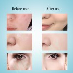 Photon Therapy Device Factory - 7 Colors Skin Rejuvenating