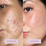 Private Label Natural Ph Balanced Sos Daily Rescue Facial Spray Repairing Purifying Hypochlorous Acid Spray for Skin Face