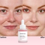 Private Label Skin Care Supplier Hydrating Moisturizing Repair Niacinamide Salmon Dna Serum